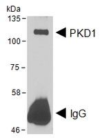 PRKD1 (aa233-246) Antibody