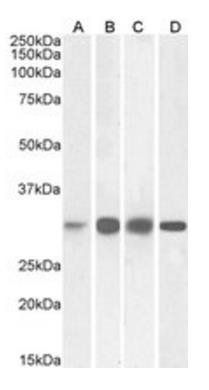 Ketohexokinase Antibody