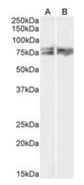 LIMK2 (aa181-193) Antibody