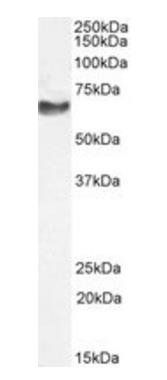 NEFL (aa330-343) Antibody