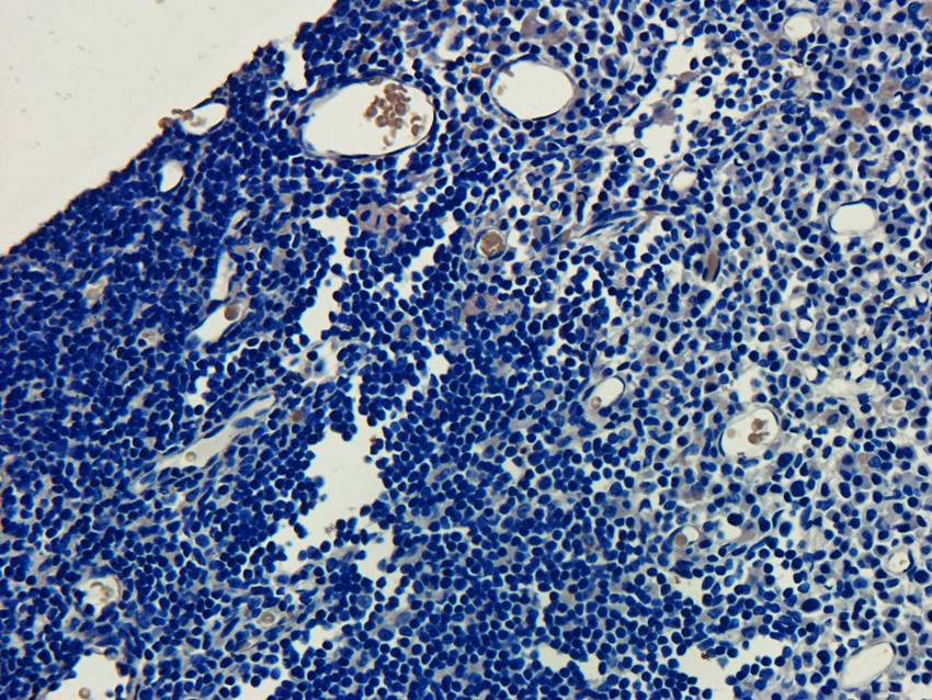 ECP Rabbit Polyclonal Antibody