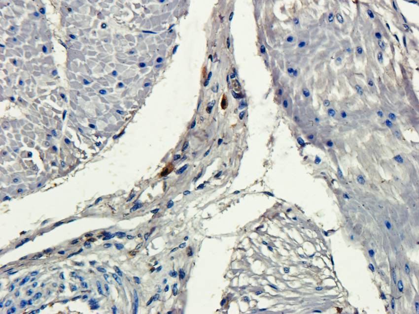 ECP Rabbit Polyclonal Antibody