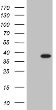 ECT2 Antibody