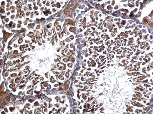 Edc3 Rabbit Polyclonal Antibody