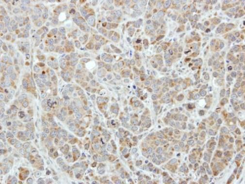 Edc3 Rabbit Polyclonal Antibody