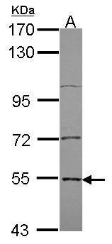 Edc3 Rabbit Polyclonal Antibody