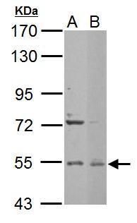 Edc3 Rabbit Polyclonal Antibody