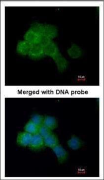 eEF2K Rabbit Polyclonal Antibody