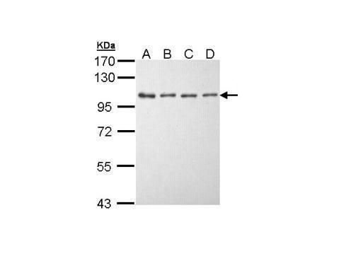 eEF2K Rabbit Polyclonal Antibody