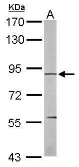 eEF2K Rabbit Polyclonal Antibody