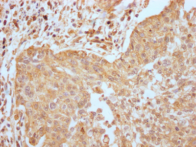 EGFR Antibody