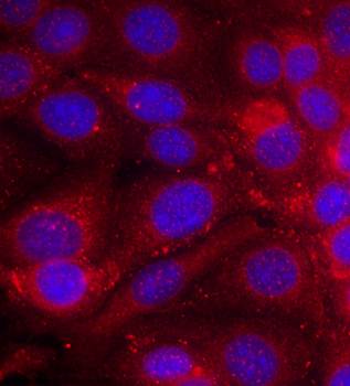 EGFR Antibody