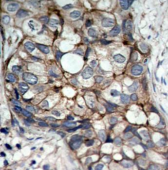 EGFR Antibody