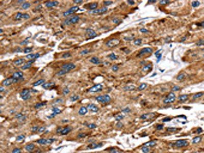 EGLN1 Antibody