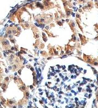 EHHADH Rabbit Polyclonal Antibody