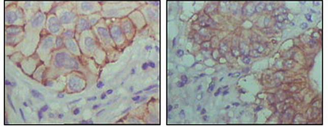 EhpB1 Antibody
