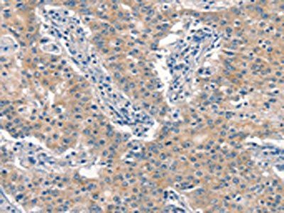 EID3 Antibody
