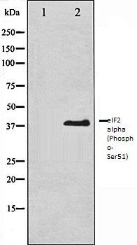 Phospho-eIF2 alpha (Ser51)[Ser52] Antibody