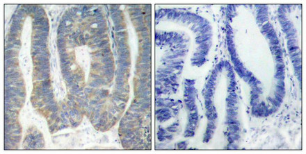 EIF2AK2 Antibody