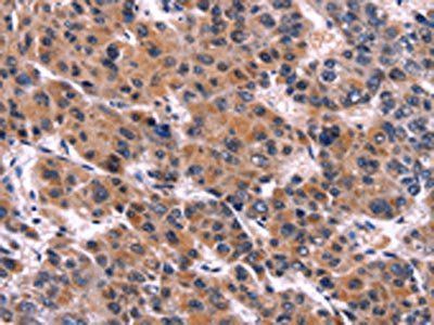 EIF2AK4 Antibody