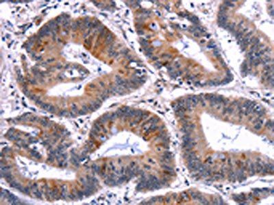 EIF2AK4 Antibody