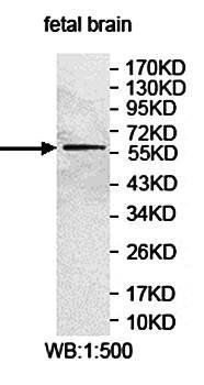 EIF3D Rabbit Polyclonal Antibody