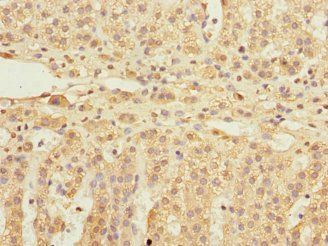 EIF3F Antibody