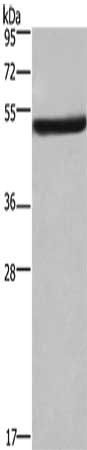 EIF3F Antibody