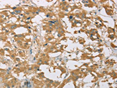 EIF3F Antibody