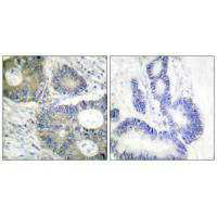 EIF4EBP1 Antibody