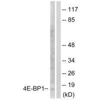 EIF4EBP1 Antibody