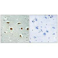 EIF4EBP1 Antibody