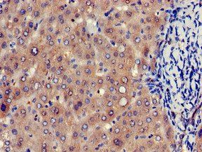 EIF4ENIF1 Antibody