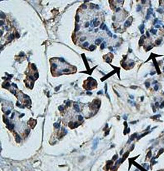 EIF4ENIF1 Rabbit Polyclonal Antibody