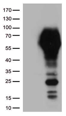 EIF5A2 Antibody