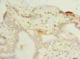 ELAVL4 Antibody