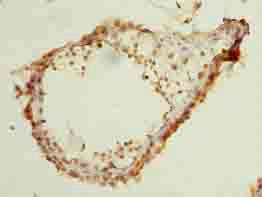 ELAVL4 Antibody