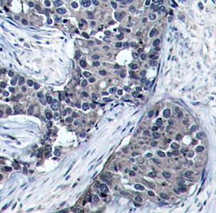 eIF4E (Phospho-Ser209) Antibody