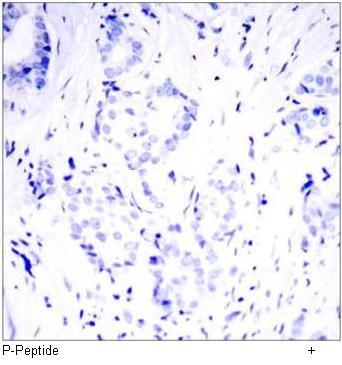 Elk1 (Phospho-Ser389) Antibody