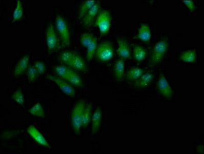 ELP3 Antibody