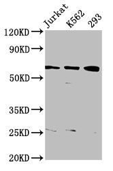 ELP3 Antibody