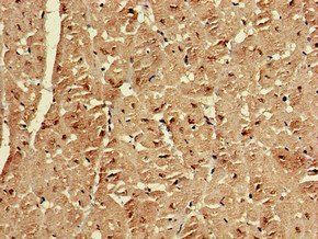 EMD Antibody