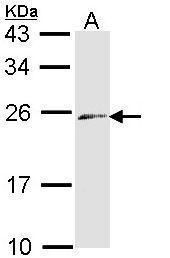 DPYD Rabbit Polyclonal Antibody