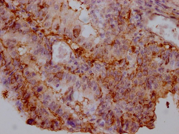 ENO1 Monoclonal Antibody