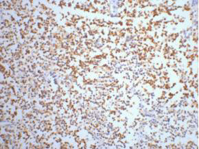 ENO2 Antibody