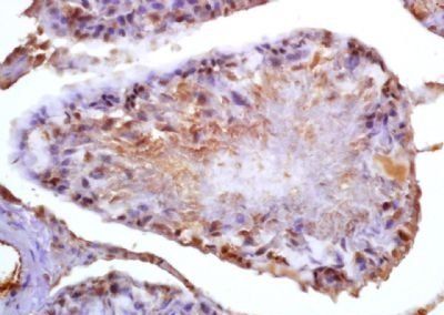 CD39L4 Rabbit Polyclonal Antibody