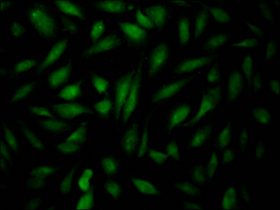 EPAS1 Antibody