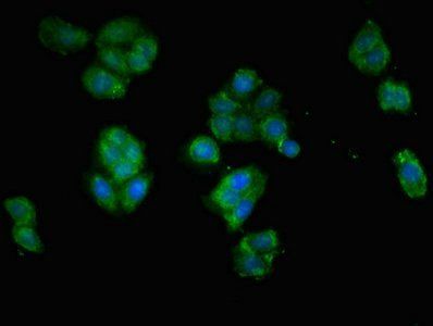 EPAS1 Antibody