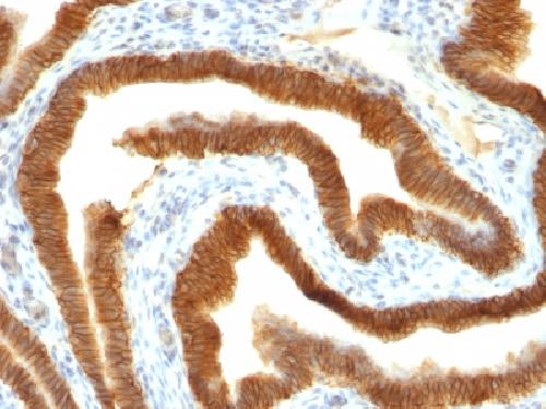 EPCAM Antibody