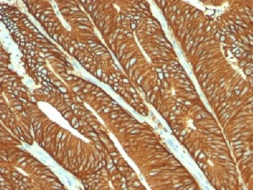EPCAM Antibody